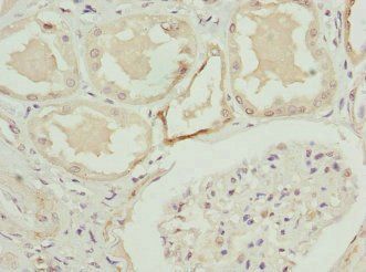 C1GALT1C1 Antibody
