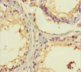 SPATA46 Antibody