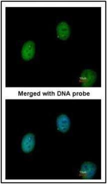 C1orf165 Rabbit Polyclonal Antibody