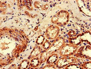 C1orf189 antibody