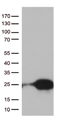 C1orf19 (TSEN15) antibody