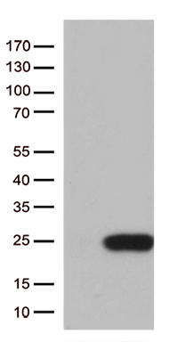 C1orf19 (TSEN15) antibody