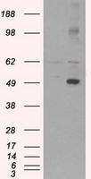 C1orf19 (TSEN15) antibody