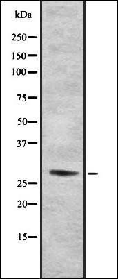 C1QTNF2 antibody