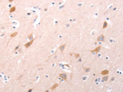 C1QTNF6 Antibody
