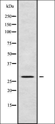 C1QTNF8 antibody
