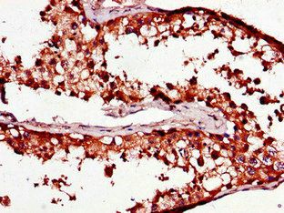 PCOTH Antibody