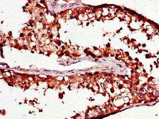 C1QTNF9B-AS1 antibody