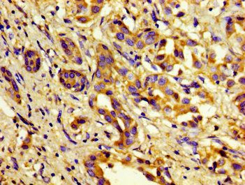 C1S Antibody
