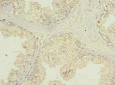 FNDC11 Antibody