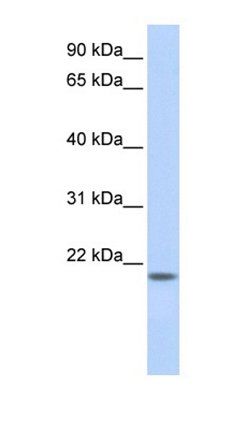 C20orf203 antibody