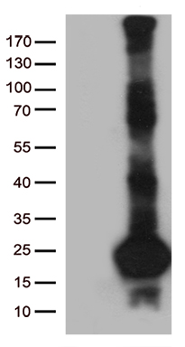 C20orf79 (SCP2D1) antibody