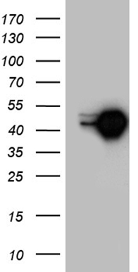 C21orf62 antibody
