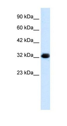 C22orf31 antibody