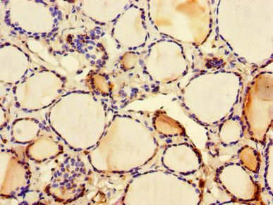 C2CD3 antibody