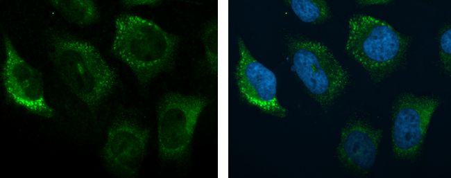C3/C3b Rabbit Polyclonal Antibody