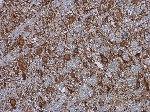 C3/C3b Rabbit Polyclonal Antibody