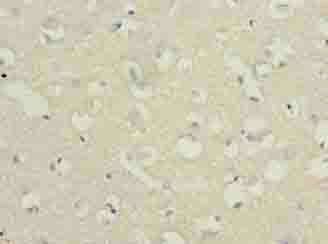 C3orf18 Antibody