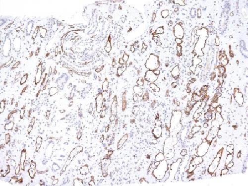 Complement 4d (C4d) (Acute Humoral Rejection Marker) Antibody