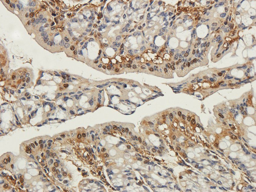 C4BPA antibody