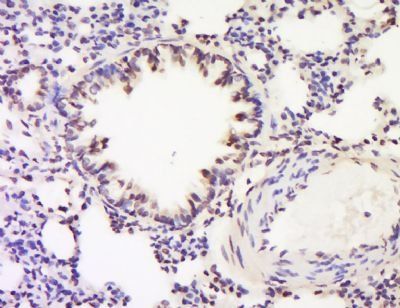 C4BPA Rabbit Polyclonal Antibody