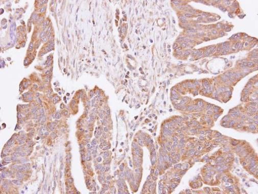 C4orf19 Rabbit Polyclonal Antibody