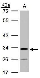 C4orf19 Rabbit Polyclonal Antibody