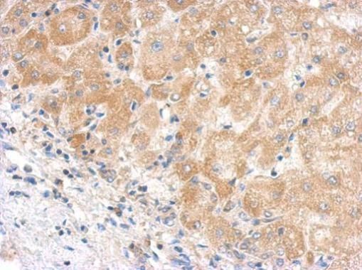 C5/C5b Rabbit Polyclonal Antibody