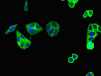 C5AR1 antibody