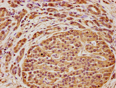 C5AR2 Antibody