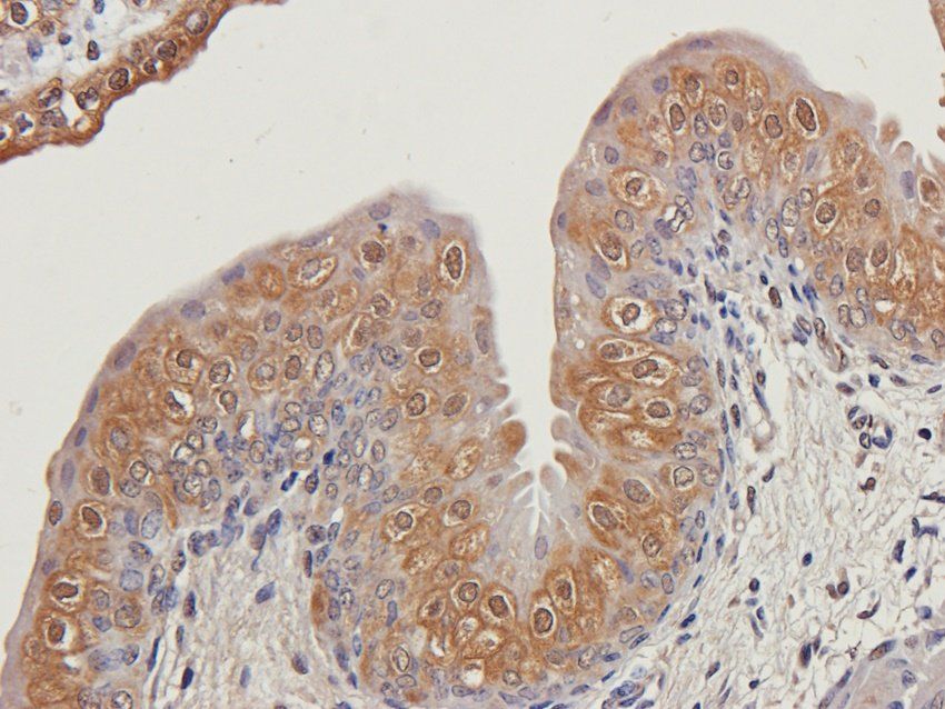 C5b-9 antibody