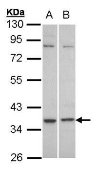 C5L2 antibody
