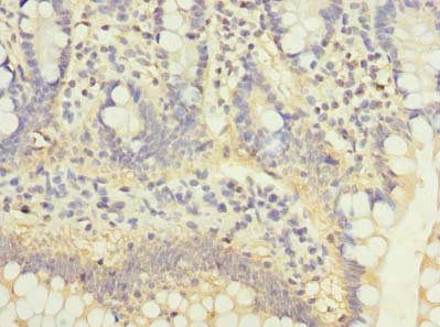 C5orf22 Antibody