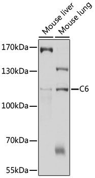 C6 antibody