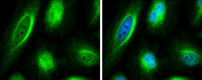 coiled-coil domain containing 170 Antibody