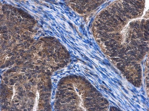 C6orf97 Rabbit Polyclonal Antibody