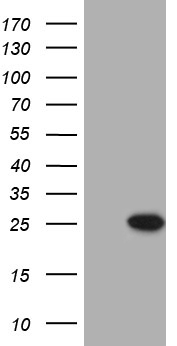 C7orf36 (YAE1D1) antibody