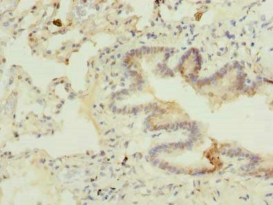 C7orf61 Antibody