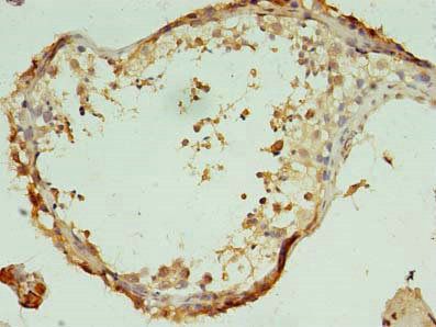 TEX47 Antibody