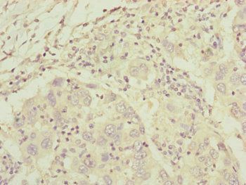 C8A Antibody
