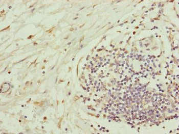 C8B Antibody