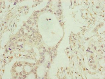 C8B Antibody