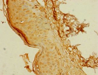 C8orf34 Antibody