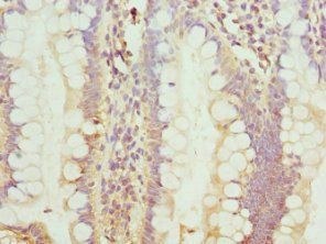 TCIM Antibody