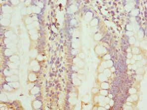 C8orf4 antibody