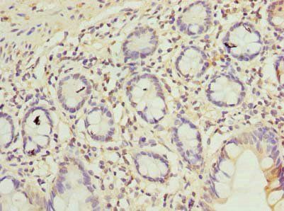 C9orf16 Antibody