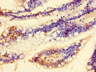 C9orf57 Antibody