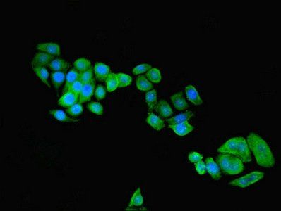 C9orf72 Antibody