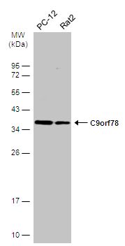 C9orf78 Rabbit Polyclonal Antibody