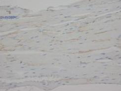 Anti-C Reactive Protein/CRP Antibody